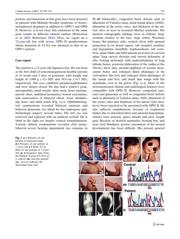 TXB0108PWRG4 datasheet.datasheet_page 2